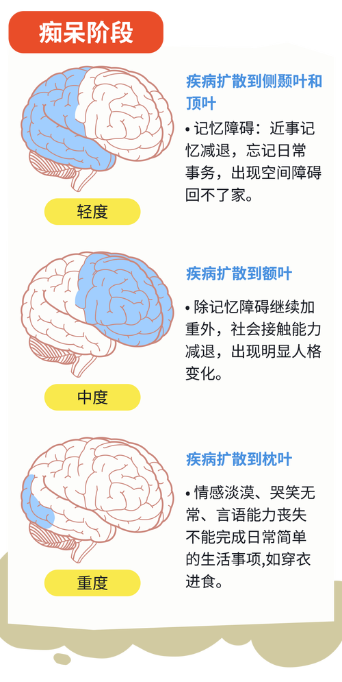 阿尔茨海默征兆(阿尔茨海默的病因)